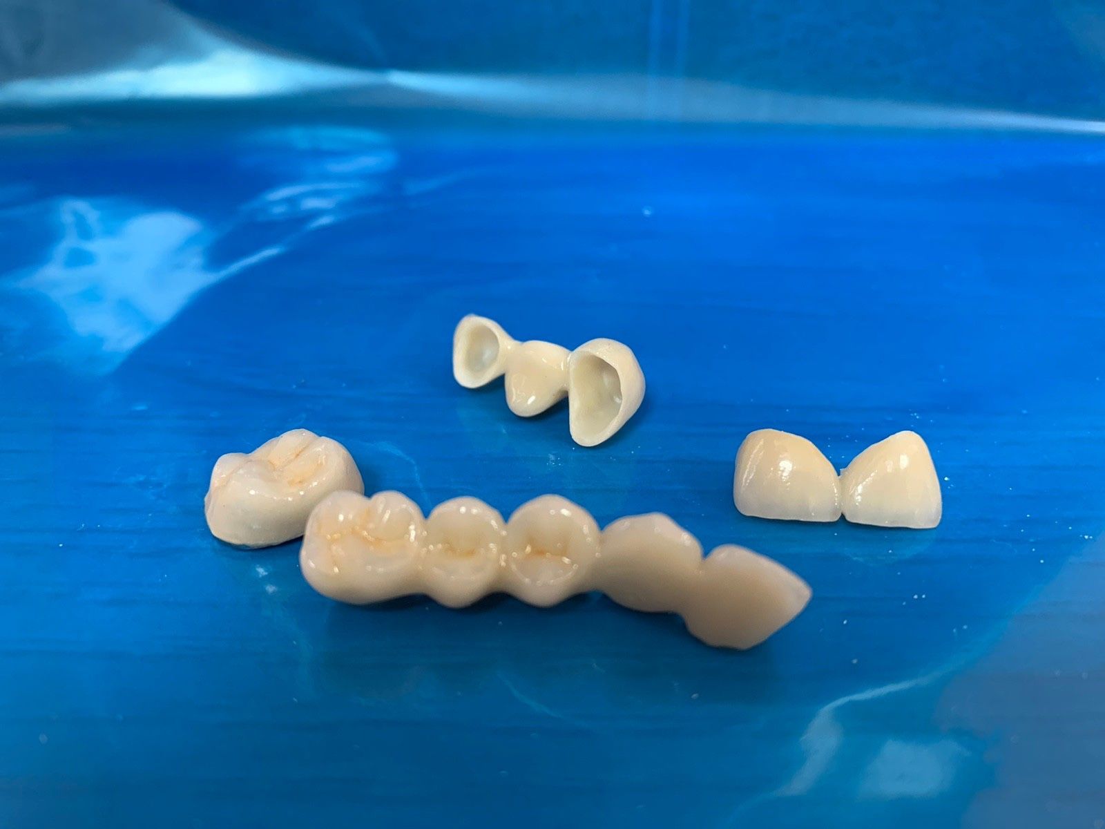 NyárFa Dent - Digitális fogászat- 3DCT, oral scanner, X-Guide