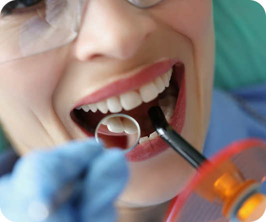 Implantátumon rögzített korona – NyárFa Dent, Győr