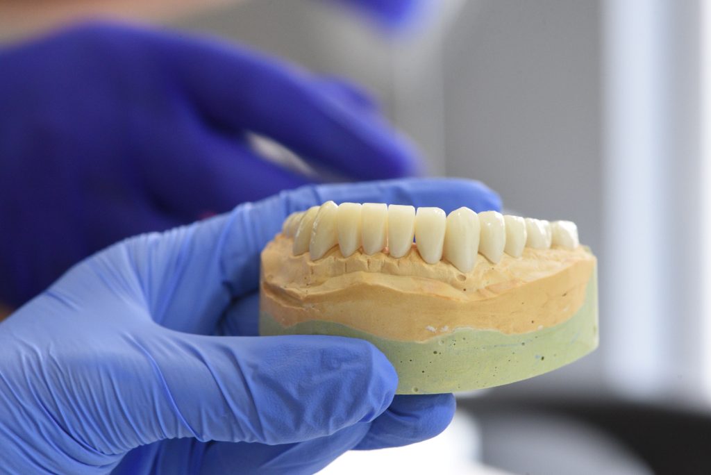 All-on-4 implantáció – NyárFa Dent, Győr